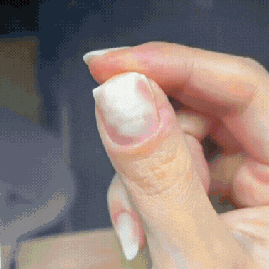 Antes y después Nativia Derm